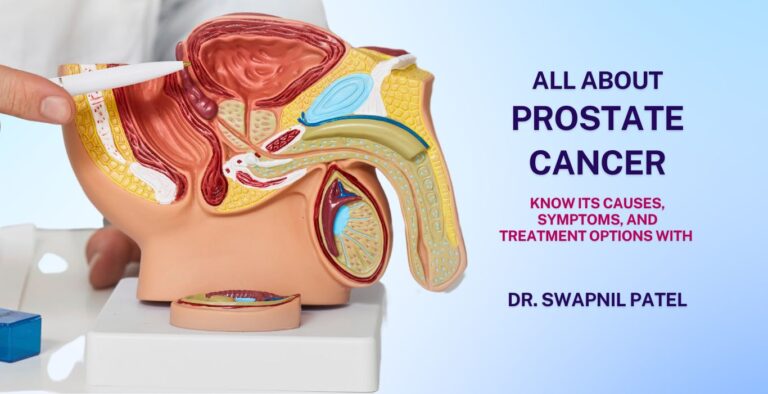 prostate Cancer treatment in Varanasi