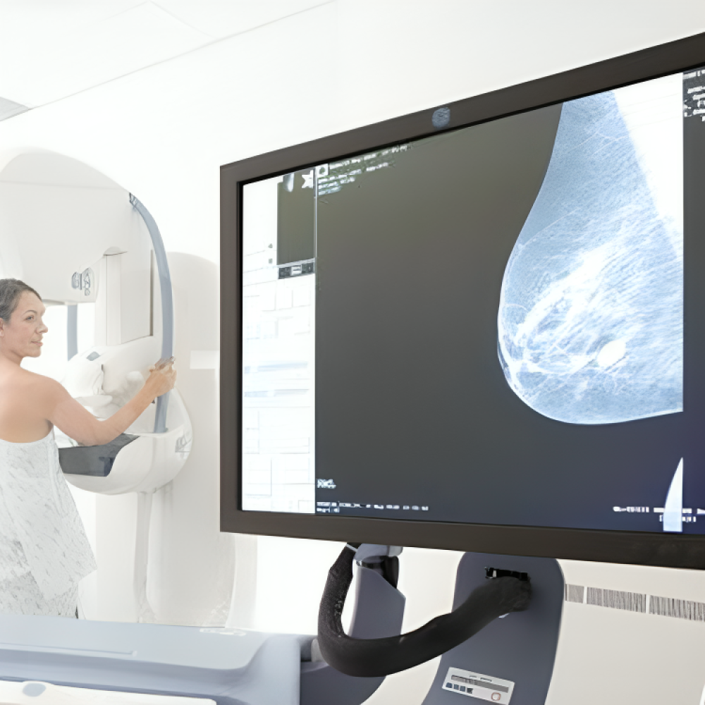 breast cancer image 2